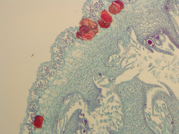 Liverwort Archegonia CS Slides - Liverwort Archegonia CS 02 100X